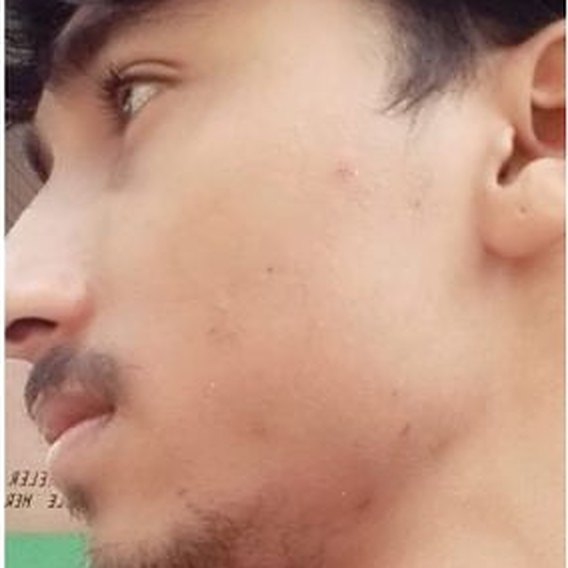 আগে: গালে প্রায় দাড়ি নেই