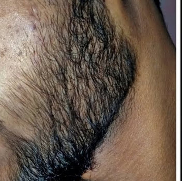 ১২০ দিন পর: চোয়ালে ঘন দাড়ি