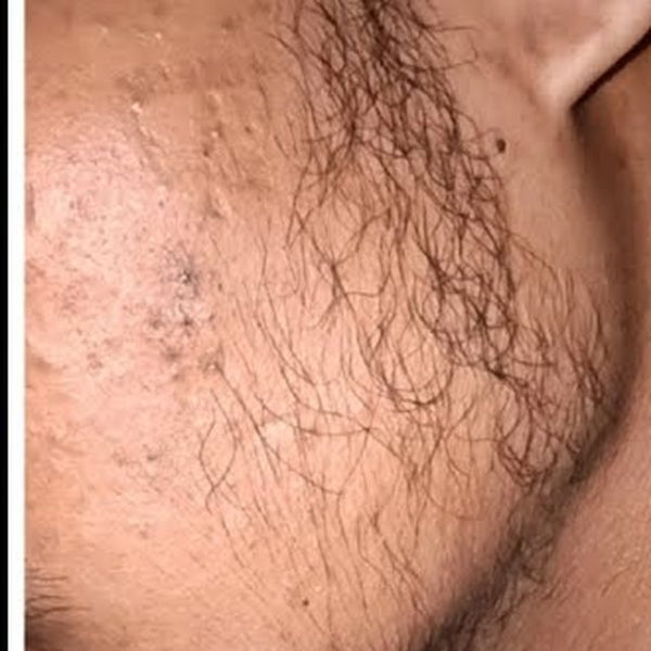 প্রথম দিন: চোয়ালে পাতলা দাড়ি